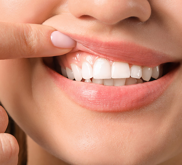 Sunset Dental | Fluoride Treatment, Emergency Treatment and Dental Fillings