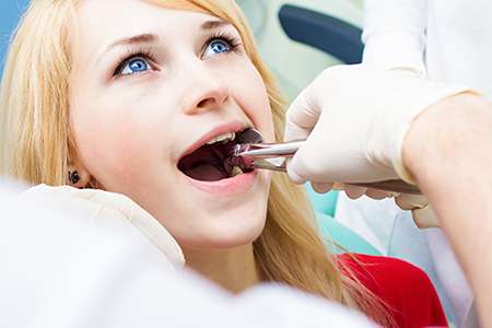 Sunset Dental | Night Guards, Botox reg  and Fluoride Treatment