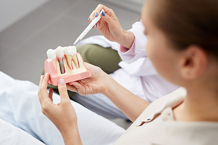 Sunset Dental | Dental Sealants, CEREC and Teeth Whitening