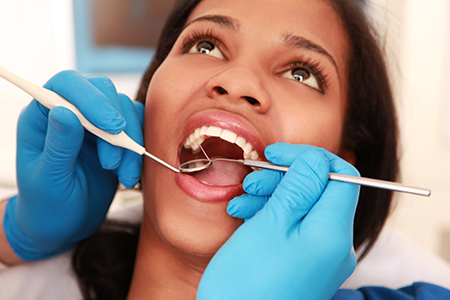 Sunset Dental | Ceramic Crowns, Dental Fillings and Root Canals