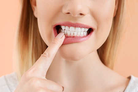 Sunset Dental | Dental Fillings, Teeth Whitening and Cosmetic Dentistry